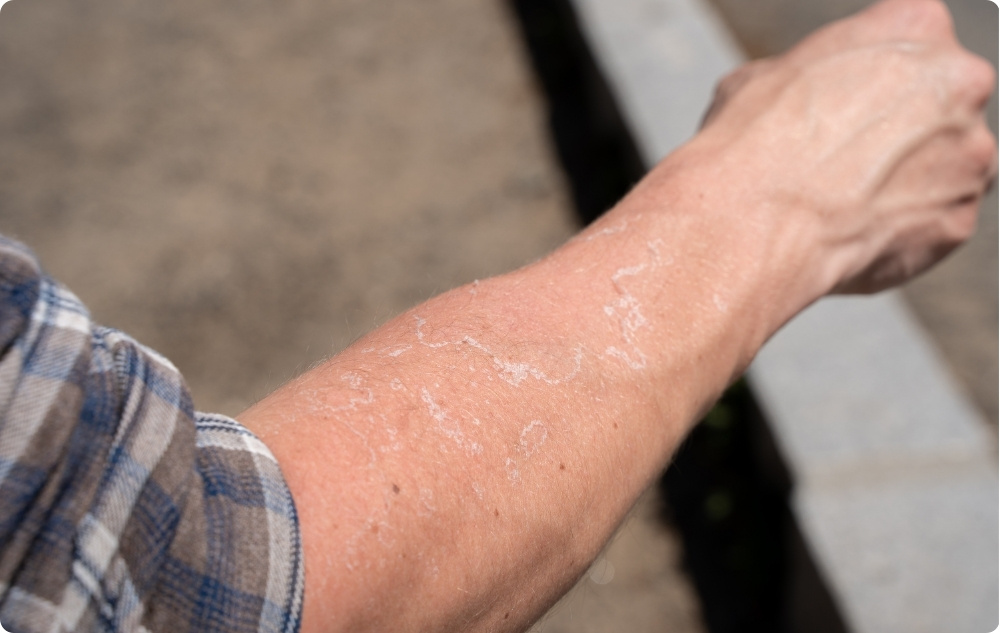 Jako olejek do skóry podrażnionej i suchej